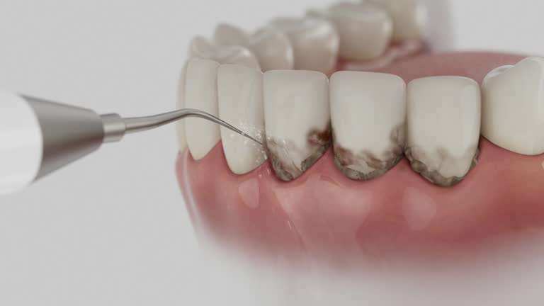 Reliable Dental Implants contractor in Cascade Locks, OR by Smile Center Dentistry
